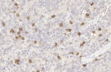 Anti-p53R2 antibody [HL1400] used in IHC (Paraffin sections) (IHC-P). GTX636840