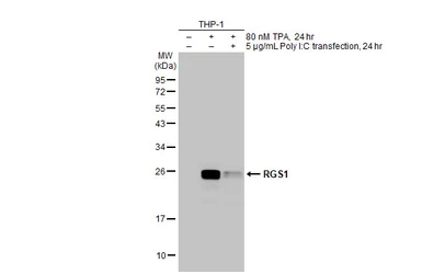Anti-RGS1 antibody [HL1402] used in Western Blot (WB). GTX636868