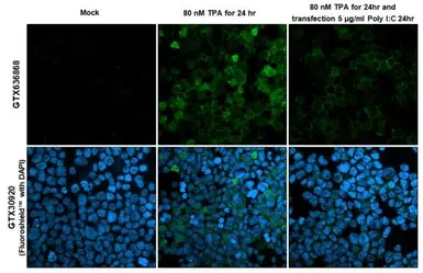 Anti-RGS1 antibody [HL1402] used in Immunocytochemistry/ Immunofluorescence (ICC/IF). GTX636868