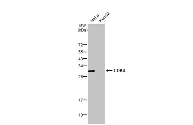 Anti-CDK4 antibody [HL1407] used in Western Blot (WB). GTX636873