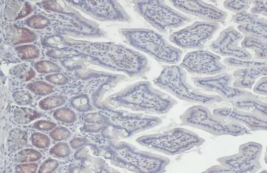 Anti-CDK4 antibody [HL1407] used in IHC (Paraffin sections) (IHC-P). GTX636873