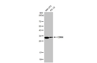 Anti-CDK4 antibody [HL1407] used in Western Blot (WB). GTX636873
