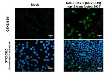 Anti-SARS-CoV-2 (COVID-19) nsp12 antibody [HL1415] used in Immunocytochemistry/ Immunofluorescence (ICC/IF). GTX636881
