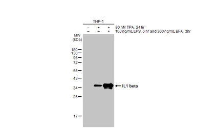 Anti-IL1 beta antibody [HL1421] used in Western Blot (WB). GTX636887