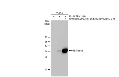 Anti-IL1 beta antibody [HL1423] used in Western Blot (WB). GTX636889