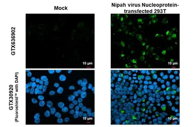 お気にいる Anti-Nipah (GTX636902 [HL1436] antibody Nucleoprotein virus 邦楽