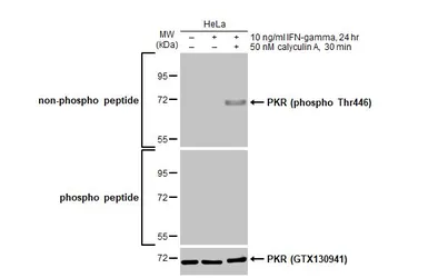 Anti-PKR (phospho Thr446) antibody [HL1439] used in Western Blot (WB). GTX636912