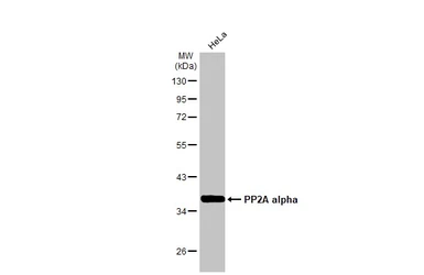 Anti-PP2A alpha antibody [HL1447] used in Western Blot (WB). GTX636919