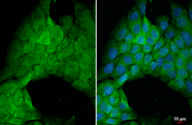 Anti-PP2A alpha antibody [HL1447] used in Immunocytochemistry/ Immunofluorescence (ICC/IF). GTX636919