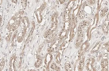 Anti-PP2A alpha antibody [HL1447] used in IHC (Paraffin sections) (IHC-P). GTX636919