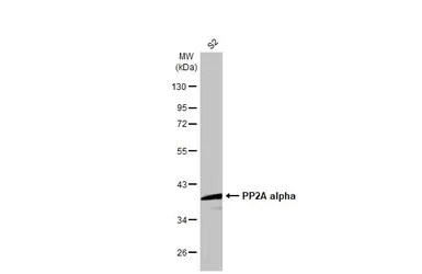 Anti-PP2A alpha antibody [HL1447] used in Western Blot (WB). GTX636919