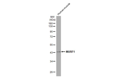 Anti-MURF1 antibody [HL1450] used in Western Blot (WB). GTX636922