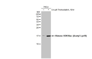 Anti-Histone H3K18ac (Acetyl Lys18) antibody [HL1463] used in Western Blot (WB). GTX636937