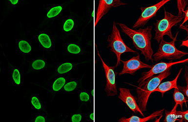 Anti-Histone H3K18ac (Acetyl Lys18) antibody [HL1463] used in Immunocytochemistry/ Immunofluorescence (ICC/IF). GTX636937