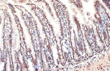 Anti-Histone H3K18ac (Acetyl Lys18) antibody [HL1463] used in IHC (Paraffin sections) (IHC-P). GTX636937