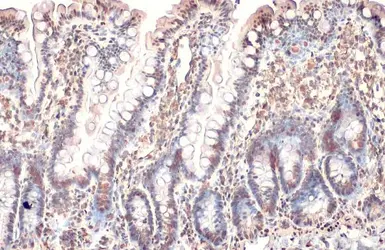 Anti-Histone H3K18ac (Acetyl Lys18) antibody [HL1463] used in IHC (Paraffin sections) (IHC-P). GTX636937