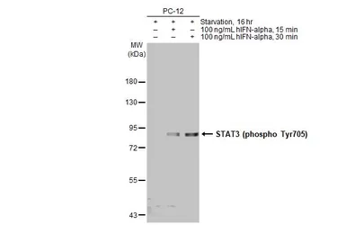 Anti-STAT3 (phospho Tyr705) antibody [HL1464] used in Western Blot (WB). GTX636938