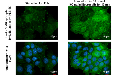 Anti-Her2 / ErbB2 (phospho Tyr1248) antibody [HL1466] used in Immunocytochemistry/ Immunofluorescence (ICC/IF). GTX636940