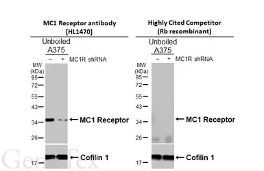 Anti-MC1 Receptor antibody [HL1470] used in Western Blot (WB). GTX636944
