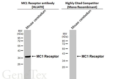 Anti-MC1 Receptor antibody [HL1470] used in Western Blot (WB). GTX636944