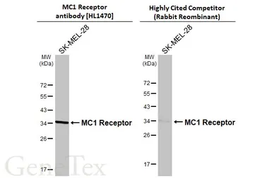 Anti-MC1 Receptor antibody [HL1470] used in Western Blot (WB). GTX636944
