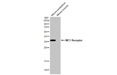 Anti-MC1 Receptor antibody [HL1470] used in Western Blot (WB). GTX636944