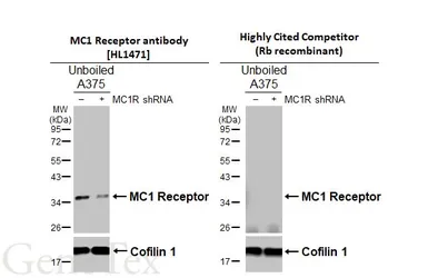 Anti-MC1 Receptor antibody [HL1471] used in Western Blot (WB). GTX636945