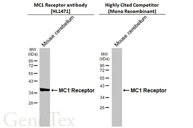 Anti-MC1 Receptor antibody [HL1471] used in Western Blot (WB). GTX636945