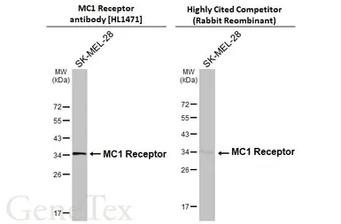 Anti-MC1 Receptor antibody [HL1471] used in Western Blot (WB). GTX636945