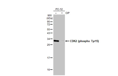 Anti-CDK2 (phospho Tyr15) antibody [HL1474] used in Western Blot (WB). GTX636948