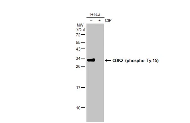 Anti-CDK2 (phospho Tyr15) antibody [HL1474] used in Western Blot (WB). GTX636948