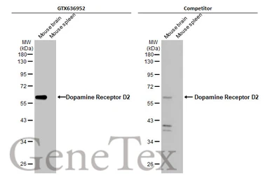 Anti-Dopamine Receptor D2 antibody [HL1478] used in Western Blot (WB). GTX636952