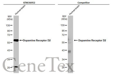 Anti-Dopamine Receptor D2 antibody [HL1478] (GTX636952