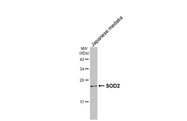 Anti-SOD2 antibody [HL1483] used in Western Blot (WB). GTX636957
