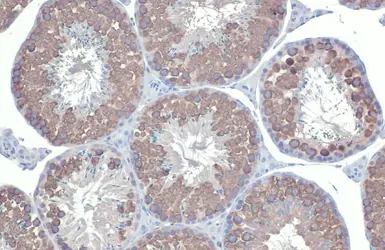 Anti-DDX4 antibody [HL1487] used in IHC (Paraffin sections) (IHC-P). GTX636961