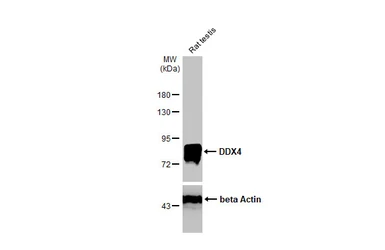 Anti-DDX4 antibody [HL1487] used in Western Blot (WB). GTX636961