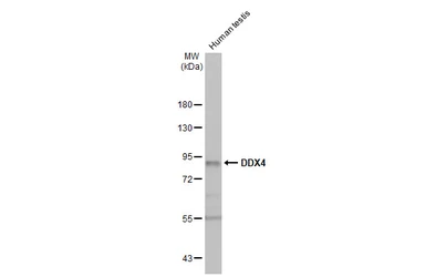 Anti-DDX4 antibody [HL1487] used in Western Blot (WB). GTX636961