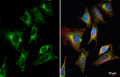 Anti-TOMM20 antibody [HL1494] used in Immunocytochemistry/ Immunofluorescence (ICC/IF). GTX636968