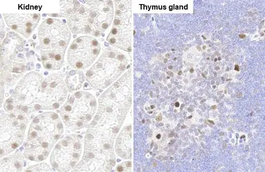 Anti-PARP3 antibody [HL1509] used in IHC (Paraffin sections) (IHC-P). GTX636983