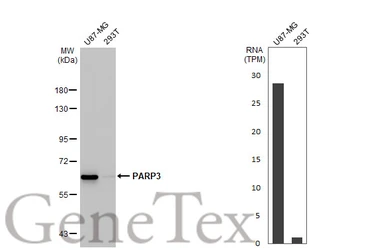 Anti-PARP3 antibody [HL1509] used in Western Blot (WB). GTX636983