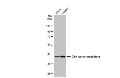 Anti-DNA polymerase beta antibody [HL1512] used in Western Blot (WB). GTX636986