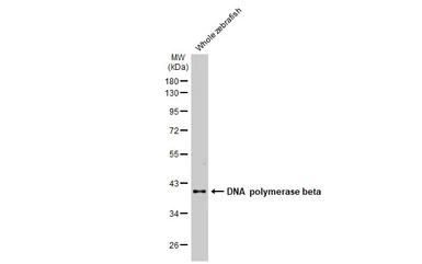 Anti-DNA polymerase beta antibody [HL1512] used in Western Blot (WB). GTX636986