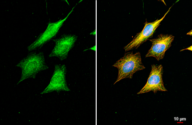 Anti-DNA polymerase beta antibody [HL1512] used in Immunocytochemistry/ Immunofluorescence (ICC/IF). GTX636986