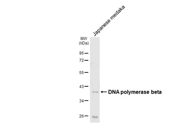 Anti-DNA polymerase beta antibody [HL1512] used in Western Blot (WB). GTX636986
