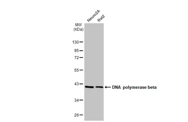 Anti-DNA polymerase beta antibody [HL1512] used in Western Blot (WB). GTX636986
