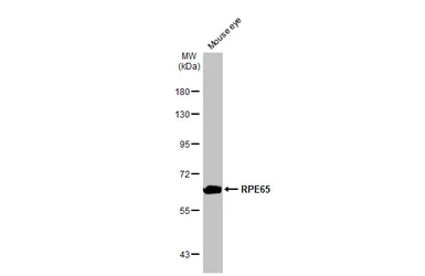Anti-RPE65 antibody [HL1519] used in Western Blot (WB). GTX636993