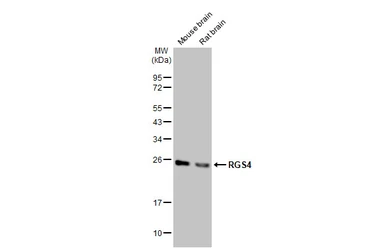 Anti-RGS4 antibody [HL1522] used in Western Blot (WB). GTX636996