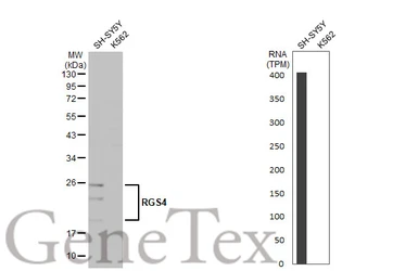 Anti-RGS4 antibody [HL1522] used in Western Blot (WB). GTX636996