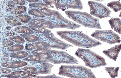 Anti-EpCAM antibody [HL1524] used in IHC (Paraffin sections) (IHC-P). GTX636998