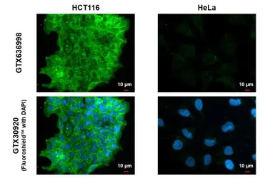 Anti-EpCAM antibody [HL1524] used in Immunocytochemistry/ Immunofluorescence (ICC/IF). GTX636998